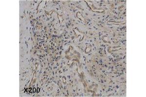 Immunohistochemical staining of IL-37 in human rheumatoid arthritis tissue. (IL-37 antibody)