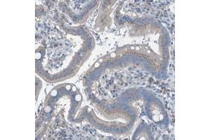 Immunohistochemical staining of human stomach with KIAA1024 polyclonal antibody  shows moderate cytoplasmic positivity in glandular cells at 1:50-1:200 dilution. (KIAA1024 antibody)