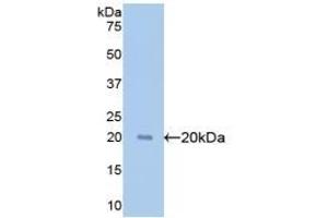 Detection of Recombinant GPC1, Human using Polyclonal Antibody to Glypican 1 (GPC1) (GPC1 antibody  (AA 114-277))