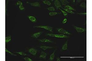 Immunofluorescence of purified MaxPab antibody to PRDX3 on HeLa cell. (Peroxiredoxin 3 antibody  (AA 1-256))