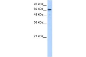 Western Blotting (WB) image for anti-ADAM Metallopeptidase Domain 30 (ADAM30) antibody (ABIN2463285) (ADAM30 antibody)