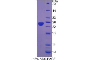 Image no. 1 for Protein Tyrosine Phosphatase Type IVA, Member 3 (PTP4A3) (AA 1-170) protein (His tag) (ABIN4989891)