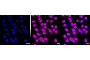 Immunocytochemical staining of HepG2 cells with APPL1 antibody (ABIN7797507), 1:1,000).