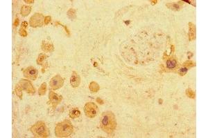 Immunohistochemistry of paraffin-embedded human placenta tissue using ABIN7167911 at dilution of 1:100