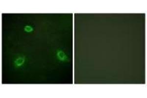Immunofluorescence analysis of HepG2 cells, using TM16G antibody. (Anoctamin 7 antibody  (C-Term))