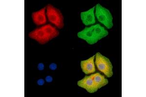 ABIN6265341 and ABIN6279794 staining Hela cells by IF/ICC. (STK25 antibody  (Internal Region))