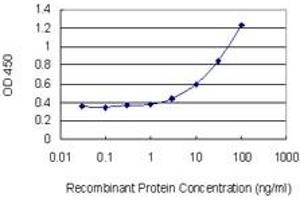 Detection limit for recombinant GST tagged UAP1 is 1 ng/ml as a capture antibody. (UAP1 antibody  (AA 406-504))