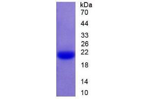 Image no. 1 for Caspase 1 (CASP1) (AA 119-296) (Active) protein (His tag) (ABIN6239879) (Caspase 1 Protein (CASP1) (AA 119-296) (His tag))
