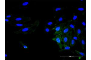 Immunofluorescence of monoclonal antibody to CD40 on HeLa cell. (CD40 antibody  (AA 21-193))