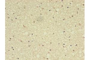 Immunohistochemistry of paraffin-embedded human brain tissue using ABIN7142894 at dilution of 1:100 (ADAMTS7 antibody  (AA 242-593))