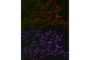 Immunofluorescence analysis of NIH-3T3 cells using CHD3 Rabbit mAb (ABIN7266363) at dilution of 1:100 (40x lens).