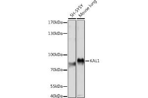 Western blot analysis of extracts of various cell lines, using K Rabbit pAb (ABIN7268068) at 1:1000 dilution. (KAL1 antibody  (AA 200-300))