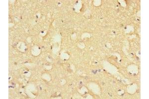 Immunohistochemistry of paraffin-embedded human brain tissue using ABIN7152410 at dilution of 1:100 (FBXO2 antibody  (AA 1-296))