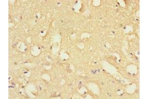 Immunohistochemistry of paraffin-embedded human brain tissue using ABIN7152410 at dilution of 1:100