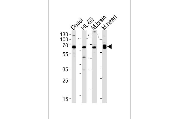 PACSIN2 antibody  (C-Term)