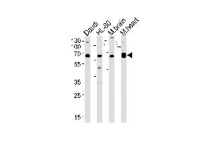 CSIN2 Antibody  (ABIN392666 and ABIN2842164) western blot analysis in Daudi,HL-60 cell line and mouse brain,rat heart lysates (35 μg/lane).
