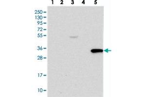 Western blot analysis of Lane 1: RT-4, Lane 2: U-251 MG, Lane 3: Human Plasma, Lane 4: Liver, Lane 5: Tonsil with TRAF3IP3 polyclonal antibody  at 1:250-1:500 dilution.