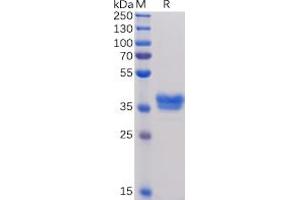 Human BCMA, mFc Tag on SDS-PAGE under reducing condition. (BCMA Protein (mFc Tag))