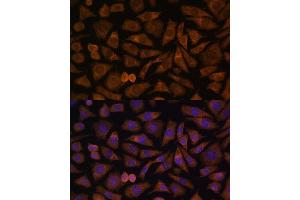 Immunofluorescence analysis of L929 cells using RABIF Polyclonal Antibody (ABIN7269786) at dilution of 1:100 (40x lens). (RABIF antibody  (AA 1-123))