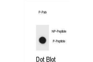 Dot blot analysis of IKKB Antibody (Phospho ) Phospho-specific Pab (ABIN1881450 and ABIN2850469) on nitrocellulose membrane.