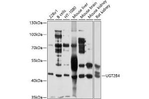 Western blot analysis of extracts of various cell lines, using UGT2B4 antibody (ABIN1683211, ABIN3018660, ABIN3018661 and ABIN6220530) at 1:1000 dilution. (UGT2B4 antibody  (AA 280-480))