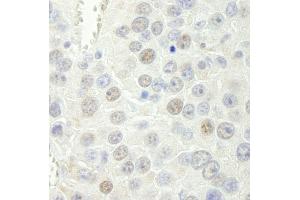 Immunohistochemistry (IHC) image for anti-RNA polymerase-associated protein RTF1 homolog (RTF1) (C-Term) antibody (ABIN7449019) (RTF1 antibody  (C-Term))