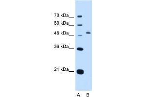 WB Suggested Anti-PAX8 Antibody Titration:  0. (PAX8 antibody  (N-Term))