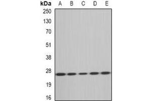 Western blot analysis of MsrA expression in HT29 (A), Hela (B), mouse heart (C), rat kidney (D), rat liver (E) whole cell lysates. (MSRA antibody)