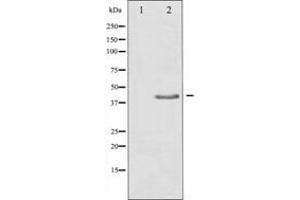 TGFB1 antibody  (C-Term)