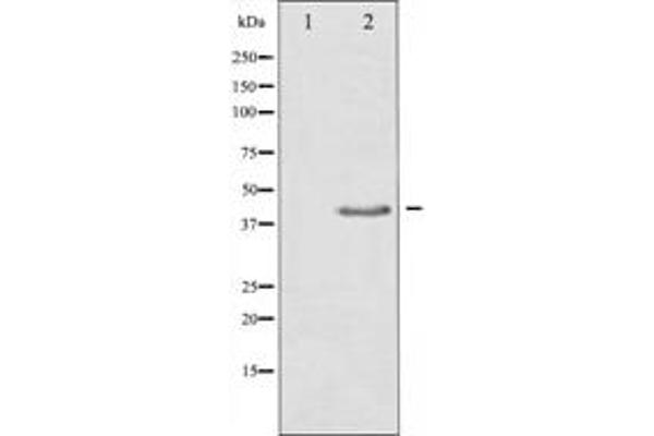 TGFB1 antibody  (C-Term)