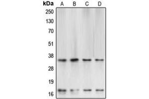 Western blot analysis of Caspase 3 expression in HeLa (A), SP2/0 (B), Raw264. (Caspase 3 antibody  (Center))