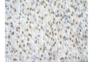 Rabbit Anti-ILF3 antibody   Paraffin Embedded Tissue: Human Heart cell Cellular Data: cardiac cell of renal tubule Antibody Concentration: 4. (Interleukin enhancer-binding factor 3 (ILF3) (N-Term) antibody)
