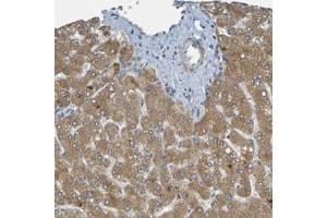 Immunohistochemical staining (Formalin-fixed paraffin-embedded sections) of human liver with CYP4F2 polyclonal antibody  shows moderate cytoplasmic positivity in hepatocytes.