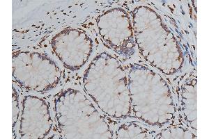 ABIN6267039 at 1/50 staining human colon tissue sections by IHC-P. (Histone 3 antibody)