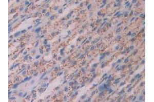 Immunohistochemistry (IHC) image for anti-Cathepsin D (CTSD) (AA 120-407) antibody (ABIN7438949)