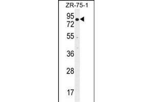 BTRC antibody  (N-Term)