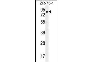 BTRC Antibody (N-term) (ABIN655814 and ABIN2845238) western blot analysis in ZR-75-1 cell line lysates (35 μg/lane). (BTRC antibody  (N-Term))