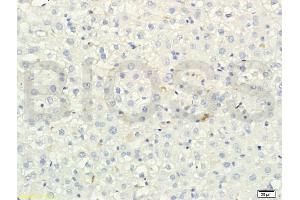 Formalin-fixed and paraffin embedded rat liver tissue labeled with Anti-SREBP-2 Polyclonal Antibody, Unconjugated (ABIN751258) at 1:200 followed by conjugation to the secondary antibody and DAB staining (SREBF2 antibody)