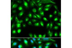Immunofluorescence analysis of A549 cells using GEMIN2 Polyclonal Antibody (SIP1 antibody)