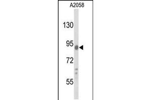 Western blot analysis of COG4 Antibody in A2058 cell line lysates (35ug/lane)