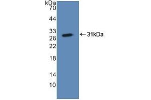 Detection of Recombinant ASGR1, Human using Polyclonal Antibody to Asialoglycoprotein Receptor 1 (ASGR1) (Asialoglycoprotein Receptor 1 antibody  (AA 77-289))