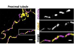 Representative STED image of the TJ in mouse proximal tubule immunostained for Cldn2 (yellow; 2nd-Atto647N) and Cldn10a (magenta; 2nd-AF594). (CLDN10 antibody  (C-Term))