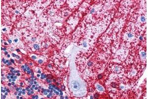 Human Brain, Cerebellum: Formalin-Fixed, Paraffin-Embedded (FFPE) (SIPA1L3 antibody  (N-Term))