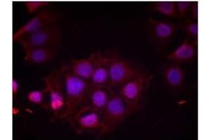 Image no. 2 for anti-Estrogen Receptor 1 (ESR1) (pSer118) antibody (ABIN196742) (Estrogen Receptor alpha antibody  (pSer118))