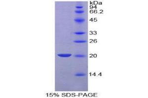 SDS-PAGE (SDS) image for Plasminogen Activator, Urokinase (PLAU) (AA 21-168) protein (His tag) (ABIN1880048) (PLAU Protein (AA 21-168) (His tag))