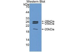 Western Blotting (WB) image for anti-Catalase (CAT) (AA 246-366) antibody (ABIN1858260) (Catalase antibody  (AA 246-366))