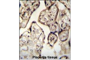 Immunohistochemistry analysis in Formalin Fixed, Paraffin Embedded Human Placenta tissue stained with SYT8 antibody (Center) followed by peroxidase conjugation of the secondary antibody and DAB staining.
