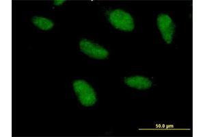 Immunofluorescence of purified MaxPab antibody to SAP18 on HeLa cell. (SAP18 antibody  (AA 1-153))
