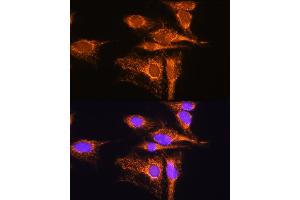 Immunofluorescence analysis of C6 cells using  Rabbit pAb (ABIN1678653, ABIN5664340, ABIN5664342 and ABIN6220284) at dilution of 1:100.