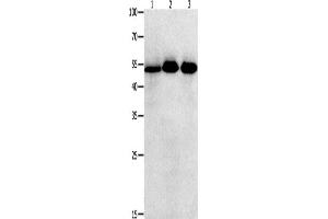 Western Blotting (WB) image for anti-Kruppel-Like Factor 5 (Intestinal) (KLF5) antibody (ABIN2431559) (KLF5 antibody)